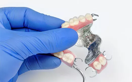 Removable partial denture